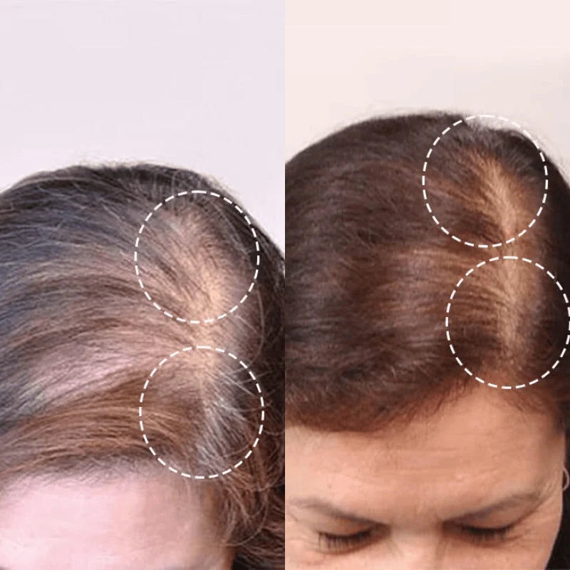 Red Light Therapy Hair Brush